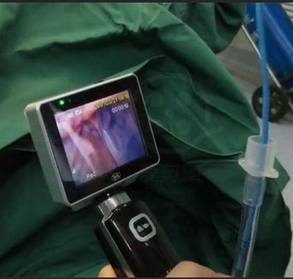 De Intubatie Videolaryngoscoop Voor éénmalig gebruik van ICU EMS met 1280 X 720 Cameraresolutie
