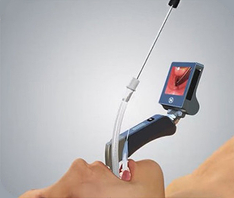 2 miljoen Videolaryngoscoop van het Pixel de Opnieuw te gebruiken Roestvrije staal met 5 Bladen