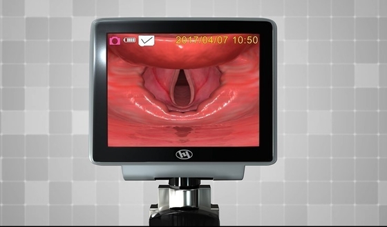 HYHJ 1320 Optische Videolaryngoscoop van de Metaal de Plastic Vezel met Beschikbare Bladen