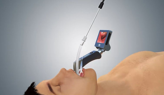 5 Mac Miller Blades Medical Digital Video-Laryngoscoop met Ergonomische Handsteel