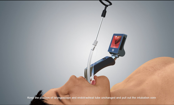 HD draagbare USB-videolaryngoscoop volwassen pediatrische Haiye Medical