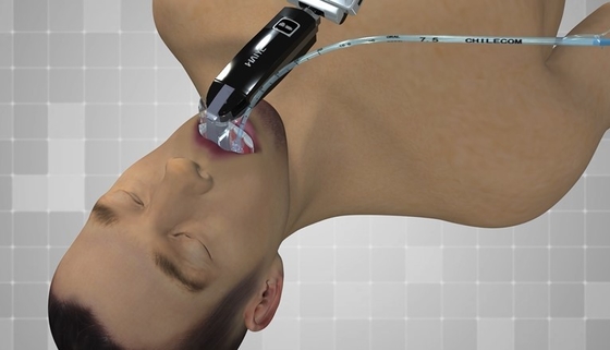 FDA verklaarde de Output Videolaryngoscoop van USB van de 3,0 Vertonings Draagbare Endoscoop