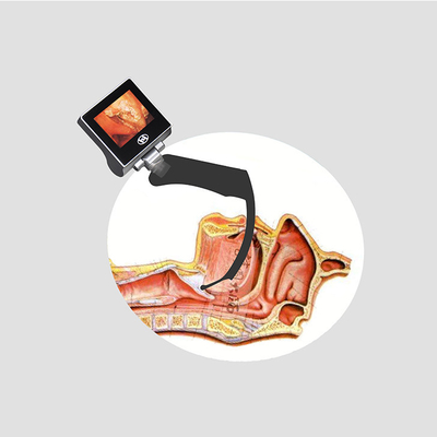 CMOS Intubatie Handheld Videolaryngoscoop Met 70 Graden Hyperangulated Glottis Visualisatie