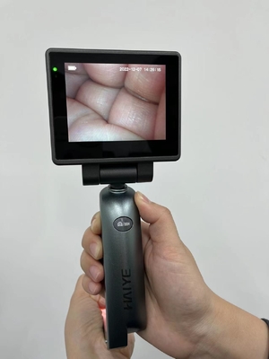 De Medische Videolaryngoscoop van de 3,0 Duimhd Vertoning - Intubatie Videolaryngoscoop