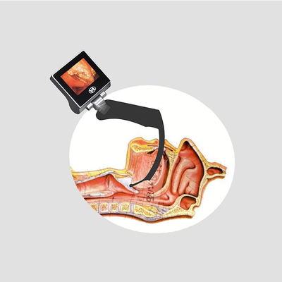 Videolaryngoscoop USB 32GB van hoge Resolutie de Draagbare Handbediende Reuable