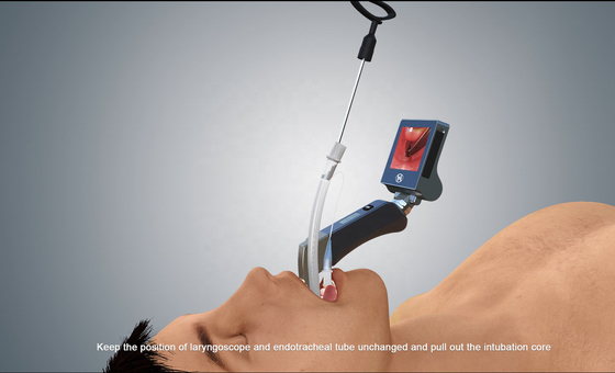3 duimlcd Intubatie Beschikbare Videolaryngoscoop 1280*720 Px