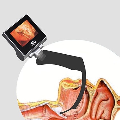 360 Graadlcd Opnieuw te gebruiken Anesthesie Videolaryngoscoop 2 Miljoen Pixel