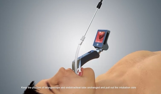 Hyhj-kc van de de Mistcamera van het medisch-Rangmetaal Materiële Digitale het Antisysteem Videolaryngoscoop