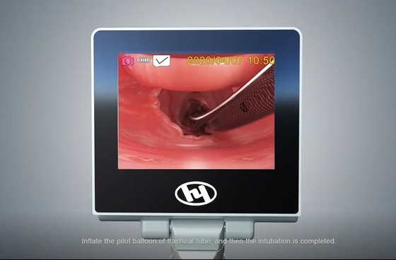 Hyhj-kc van de de Mistcamera van het medisch-Rangmetaal Materiële Digitale het Antisysteem Videolaryngoscoop